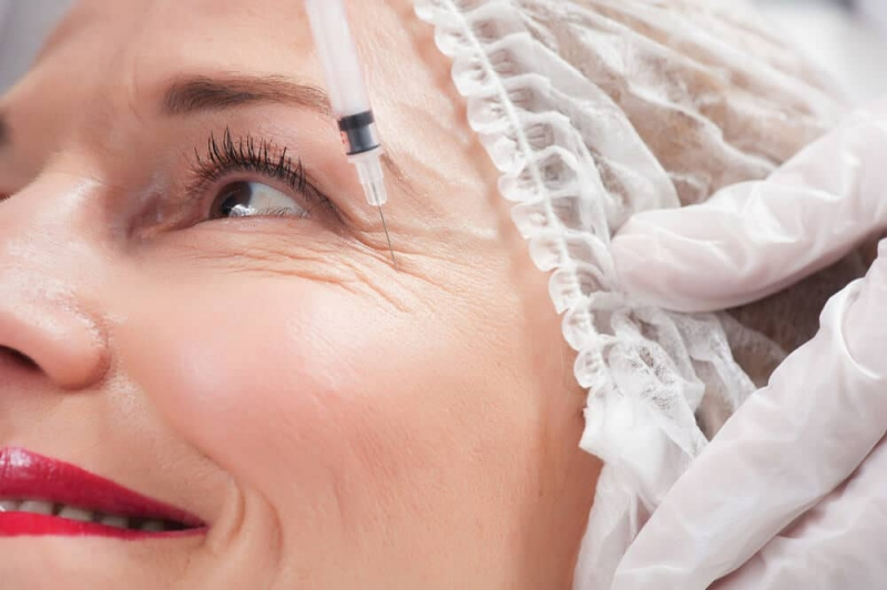 Qual O Valor Do Botox Na Area Dos Olhos - Sobre os Olhos