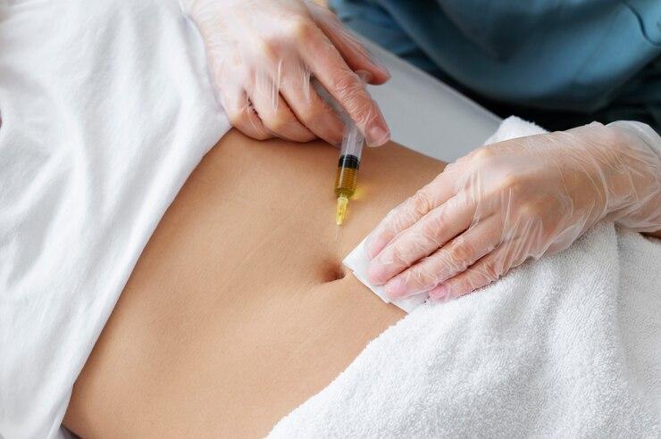 Bioestimulador de Colágeno na Barriga: Como Funciona e Seus Benefícios Bioestimulador de Colágeno na Barriga: Como Funciona e Seus Benefícios