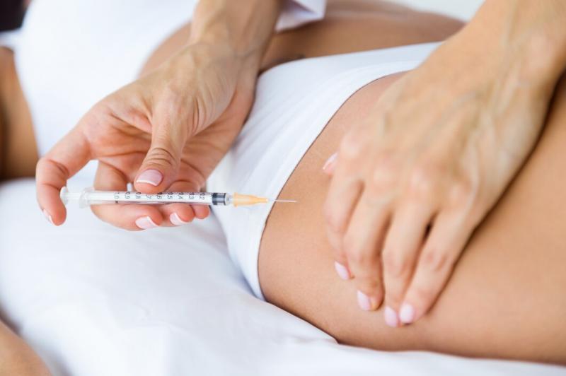 Bioestimulador de Colágeno no Glúteo: Benefícios e Resultados Bioestimulador de Colágeno no Glúteo: Benefícios e Resultados